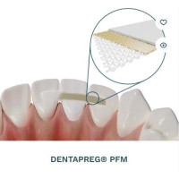 Dentapreg Bridge PFM, Пак.: 1 х стрічка 50мм довжина= 50 мм; шир.= 3 мм; товщ.= 0.3 мм - Шинуюча стрічка (скловолокно) (ADM/А-Ді-Ем)