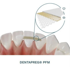 Dentapreg Bridge PFM, Пак.: 1 х стрічка 50мм довжина= 50 мм; шир.= 3 мм; товщ.= 0.3 мм - Шинуюча стрічка (скловолокно) (ADM/А-Ді-Ем)