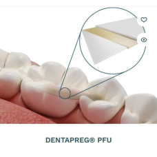 Dentapreg Bridge PFU, Пак.: 1 х стрічка 50мм довжина= 50 мм; шир.= 2 мм; товщ.= 0.3 мм - Шинуюча стрічка (скловолокно) (ADM/А-Ді-Ем)