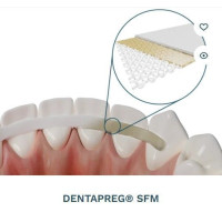 Dentapreg Splint SFM № 2-14-007, Пак.: 1 х стрічка 50мм довжина= 50 мм; шир.= 2 мм; товщ.= 0.2 мм - Шинуюча стрічка (скловолокно) (ADM/А-Ді-Ем)