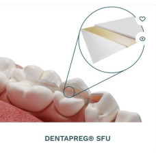 Dentapreg Splint SFU № 2-14-007, Пак.: 1 х стрічка 50мм довжина= 50 мм; шир.= 2 мм; товщ.= 0.2 мм - Шинуюча стрічка (скловолокно) (ADM/А-Ді-Ем)