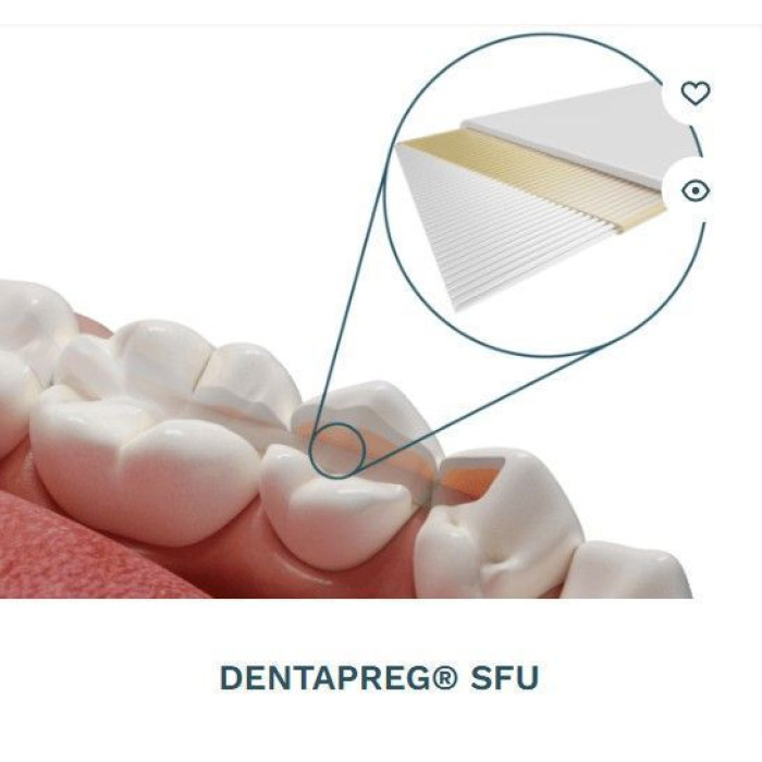 Dentapreg Splint SFU № 2-14-007, Пак.: 1 х стрічка 50мм довжина= 50 мм; шир.= 2 мм; товщ.= 0.2 мм - Шинуюча стрічка (скловолокно) (ADM/А-Ді-Ем)