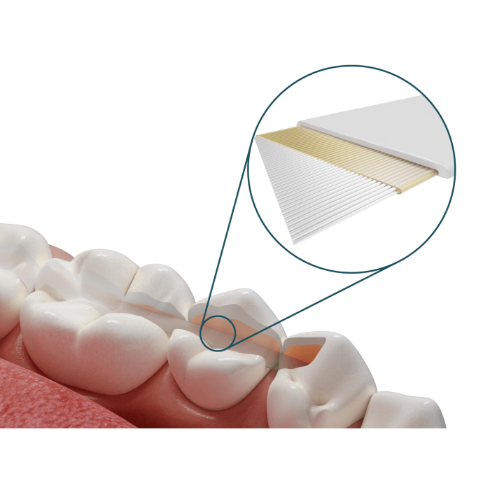 Dentapreg Splint SFU № 2-14-007, Пак.: 1 х стрічка 50мм довжина= 50 мм; шир.= 2 мм; товщ.= 0.2 мм - Шинуюча стрічка (скловолокно) (ADM/А-Ді-Ем)