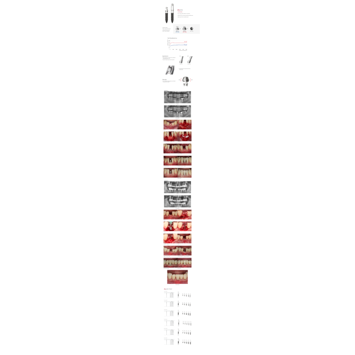 Імплантат кулькова опора SlimLine (SlimOneBody) (СлімЛайн (СлімВанБоді)) № EBS252014, 1шт діам.= 2.50 мм; довжина= 14 мм; вис.ясен.= 2.0 мм (Dentium/Дентіум)