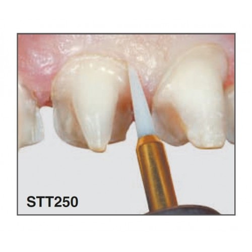 Trimmer Soft Tissue (Тріммер Софт Тіссу) № STT250.314.016, 1шт форма: голкоподібний; (L= 19 мм); діам.= 1.60 мм; роб.част.= 8.0 мм - Тріммер керамічний під ТН (Edenta/Едента) Trimmer Soft Tissue (Тріммер Софт Тіссу) № STT250.314.016, 1шт форма: голкоподібний; (L= 19 мм); діам.= 1.60 мм; роб.част.= 8.0 мм - Тріммер керамічний під ТН (Edenta/Едента)