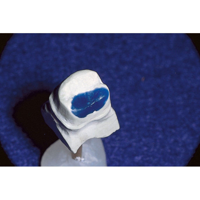 LC Block-Out Resin (ЛС Блок Аут Резін) № 242, шпр.1.2мл (синій) - Смола лабораторна (Ultradent/Ультрадент)