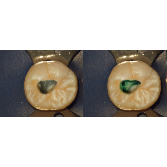 Sable Seek (Сейбл Сіік) № 1805, шпр.1.2мл (зелений) - Індикатор карієсу (Ultradent/Ультрадент)