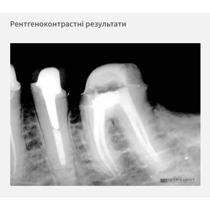 Endo-Rez (Ендо-Рез) № 5900, Пак.: подв.шпр. 11г - Цемент для каналів (композитний) (Ultradent/Ультрадент)