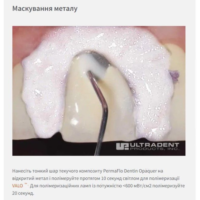 PermaFlo (ПермаФло) № 1005, шпр.1.2мл (DO) - Текучий композит, мікрогібридний (Ultradent/Ультрадент)