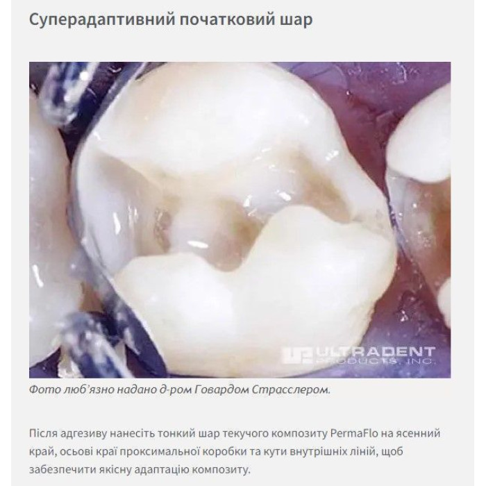 PermaFlo (ПермаФло) № 1005, шпр.1.2мл (DO) - Текучий композит, мікрогібридний (Ultradent/Ультрадент)
