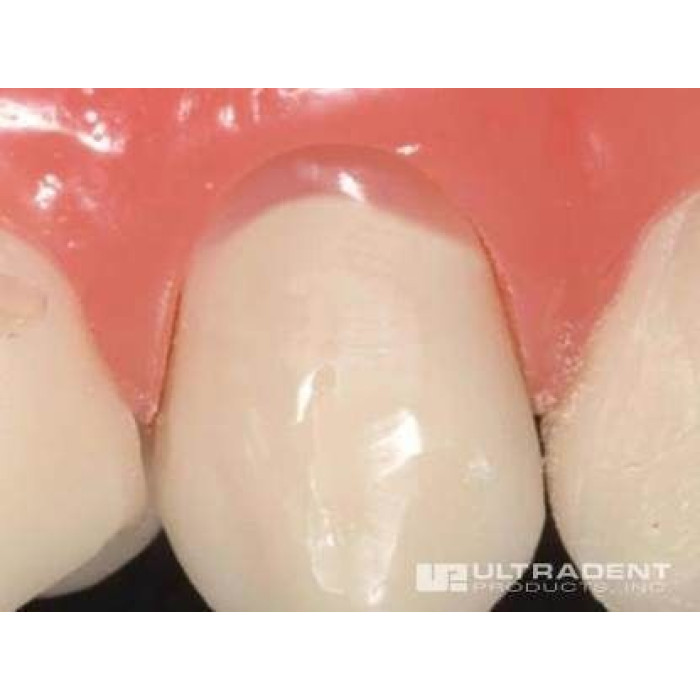 PermaFlo (ПермаФло) № 963, 963-1, шпр.1.2мл (Pink) - Текучий композит, мікрогібридний (Ultradent/Ультрадент)