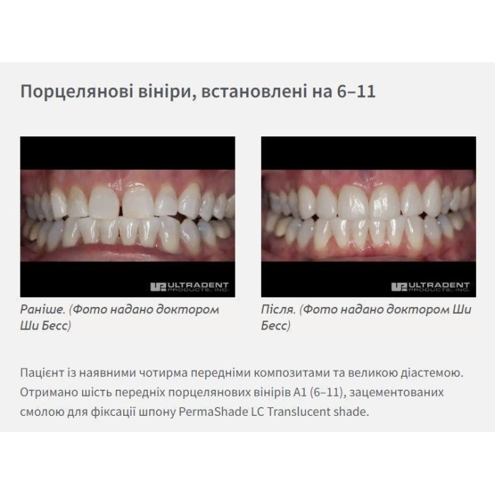 PermaShade LC (Перма Шейд) № 5227, шпр.0.95г (T) - Фіксуючий цемент, композитний (Ultradent/Ультрадент)
