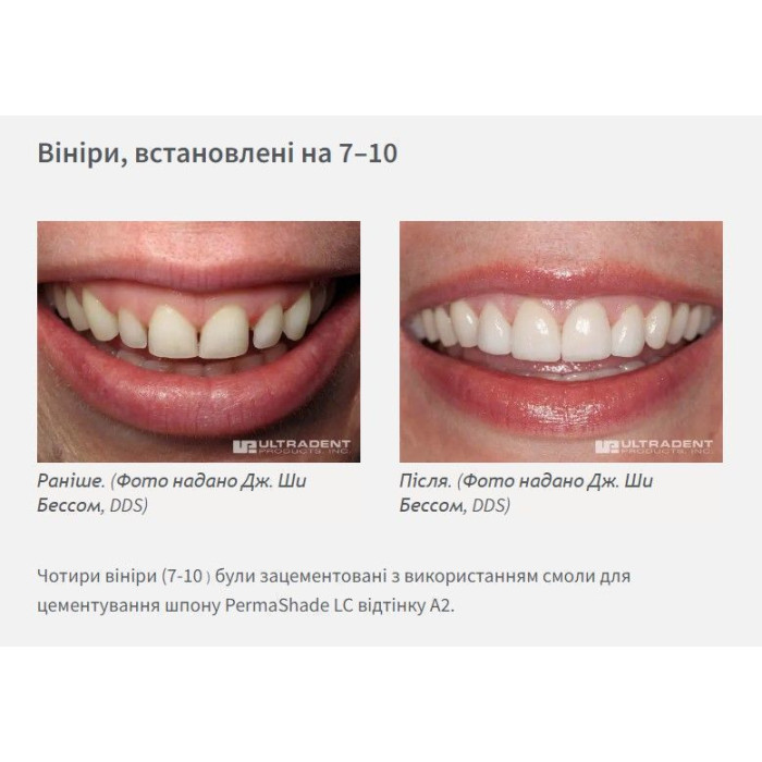 PermaShade LC (Перма Шейд) № 5227, шпр.0.95г (T) - Фіксуючий цемент, композитний (Ultradent/Ультрадент)