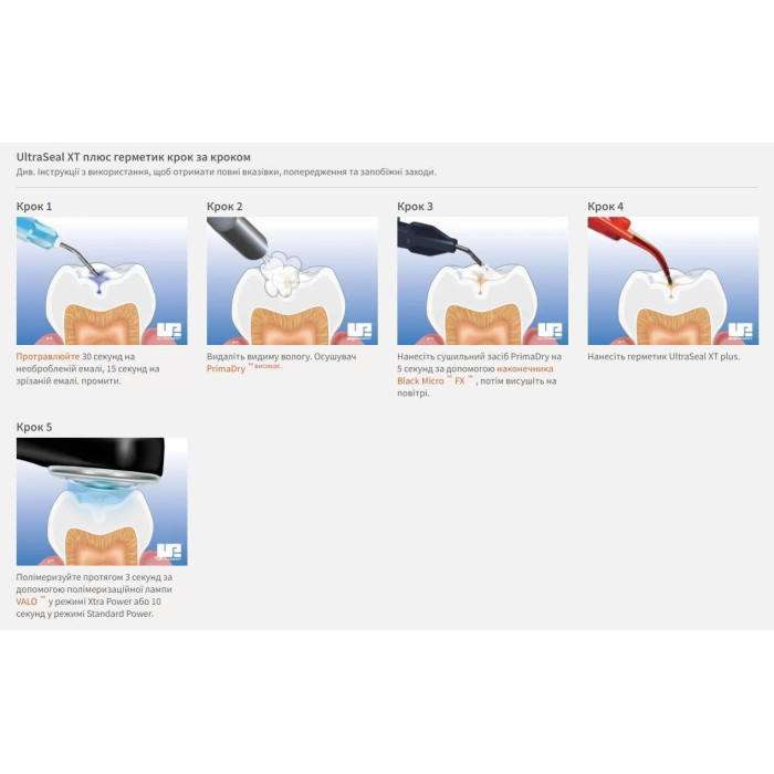 UltraSeal XT Plus (Ультрасіл Плюс) № 1289, шпр.1.2мл (A1) - Фісурний герметик (Ultradent/Ультрадент)