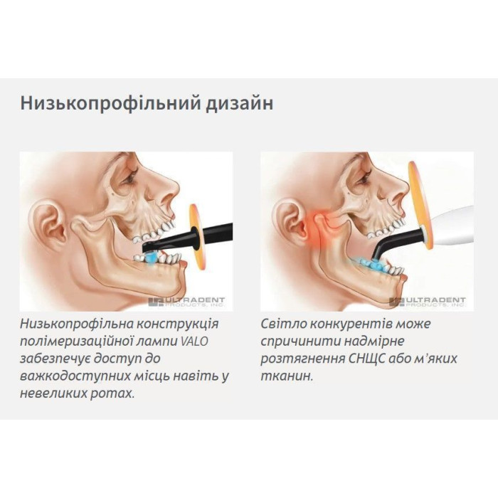 Фотополімеризатор бездротовий (акум) VALO Cordless № 5941, Н-р: , (# ЗНЯТО З ВИРОБНИЦТВА  #) (Ultradent/Ультрадент)