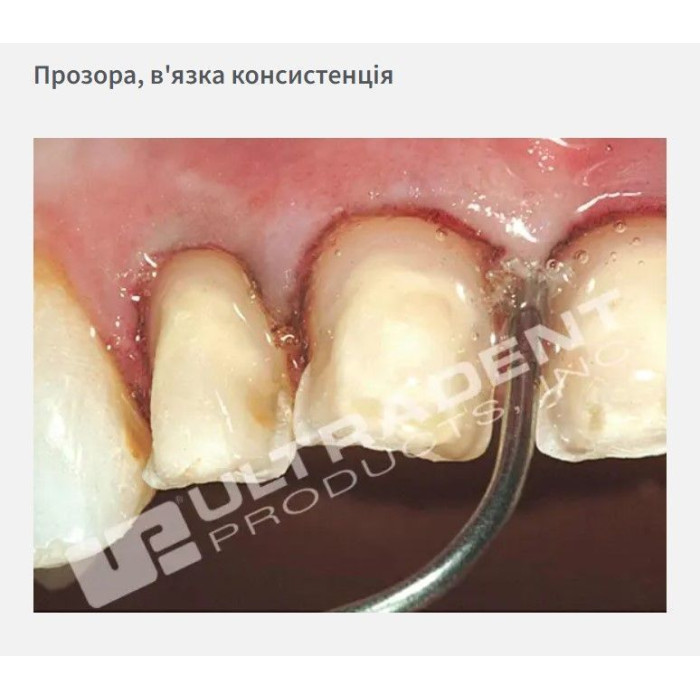 Viscostat Clear (Віскостат Клір) № 6408, шприц-диспенсер 30мл - Гемостатик-гель (хлорид алюмінію 25%) (Ultradent/Ультрадент)